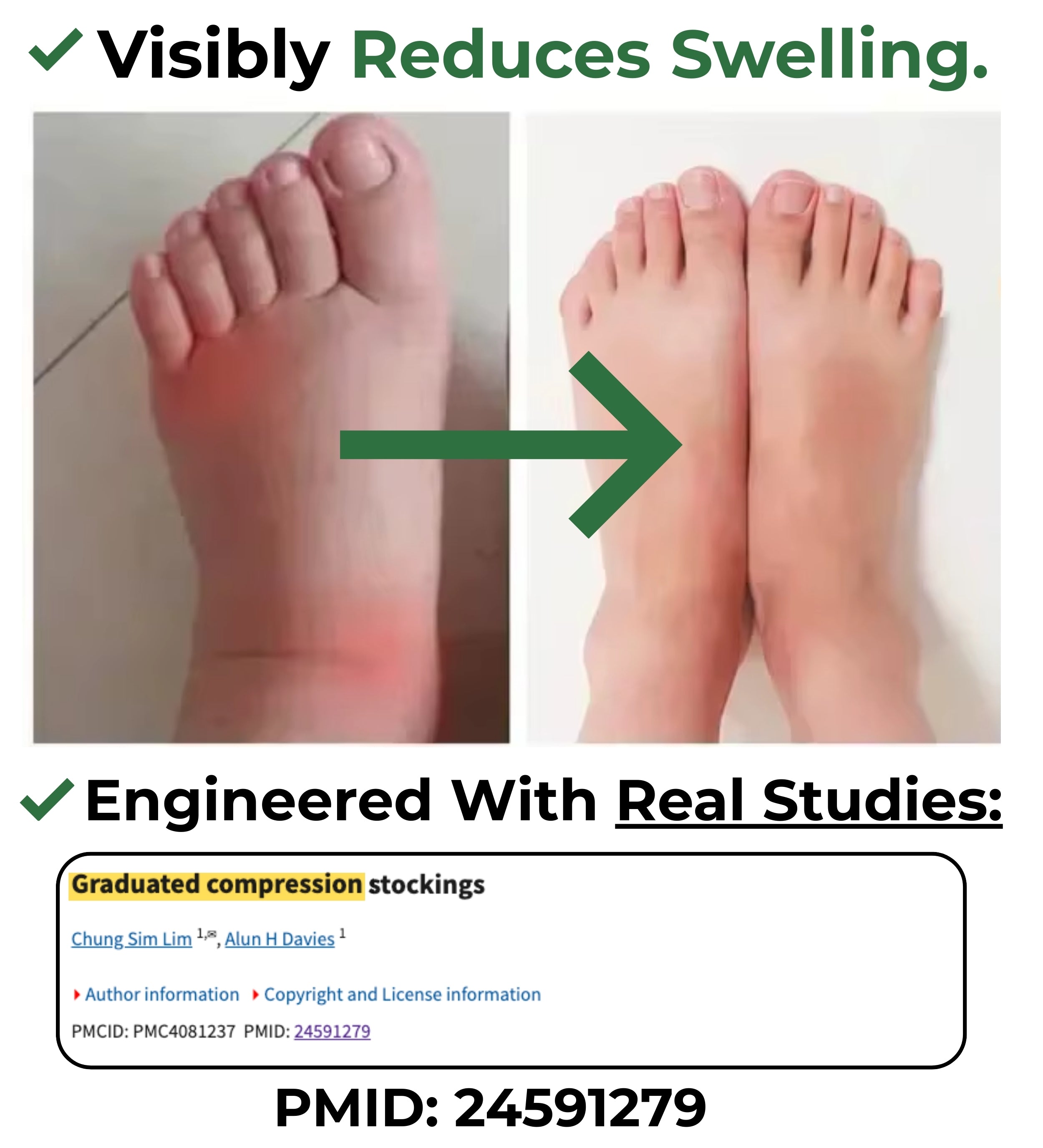 TheRelief™ Wide Compression Socks